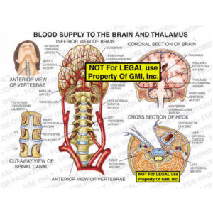 The exhibit illustrates the blood supply to the brain and thalamus with inferior and coronal section views of the brain, an anterior view of the vertebrae, cross section view of the neck, and cut-away view of the spinal canal.