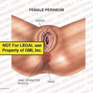 The exhibit illustrates the female perineum showing, vagina, anal sphincter muscle, and anus.
